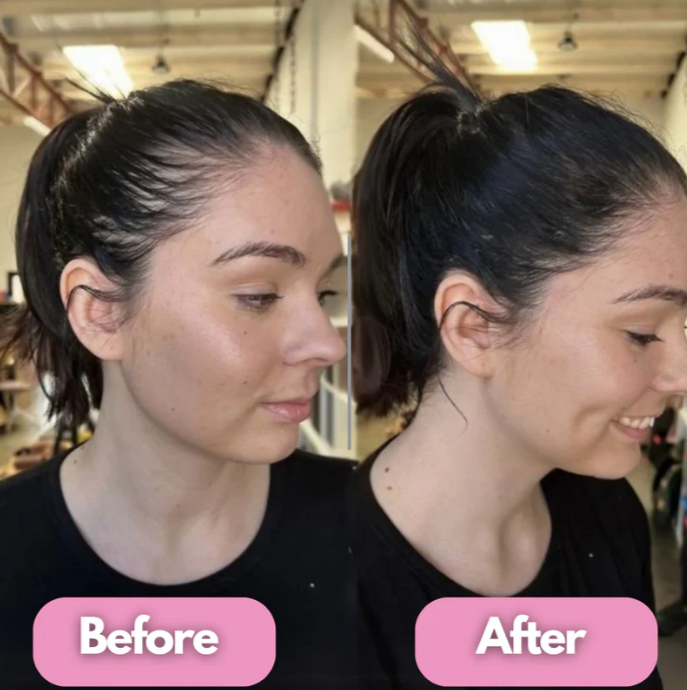 Revitaluxe Hair Therapy Brush™