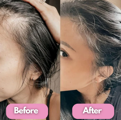 Revitaluxe Hair Therapy Brush™