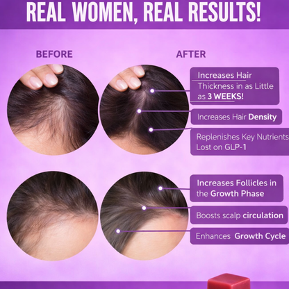 GLP-1 Hair Revival Chews™