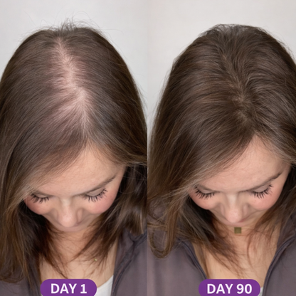 GLP-1 Hair Revival Chews™