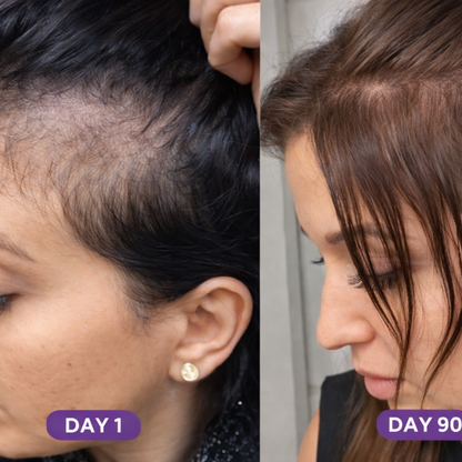 GLP-1 Hair Revival Chews™